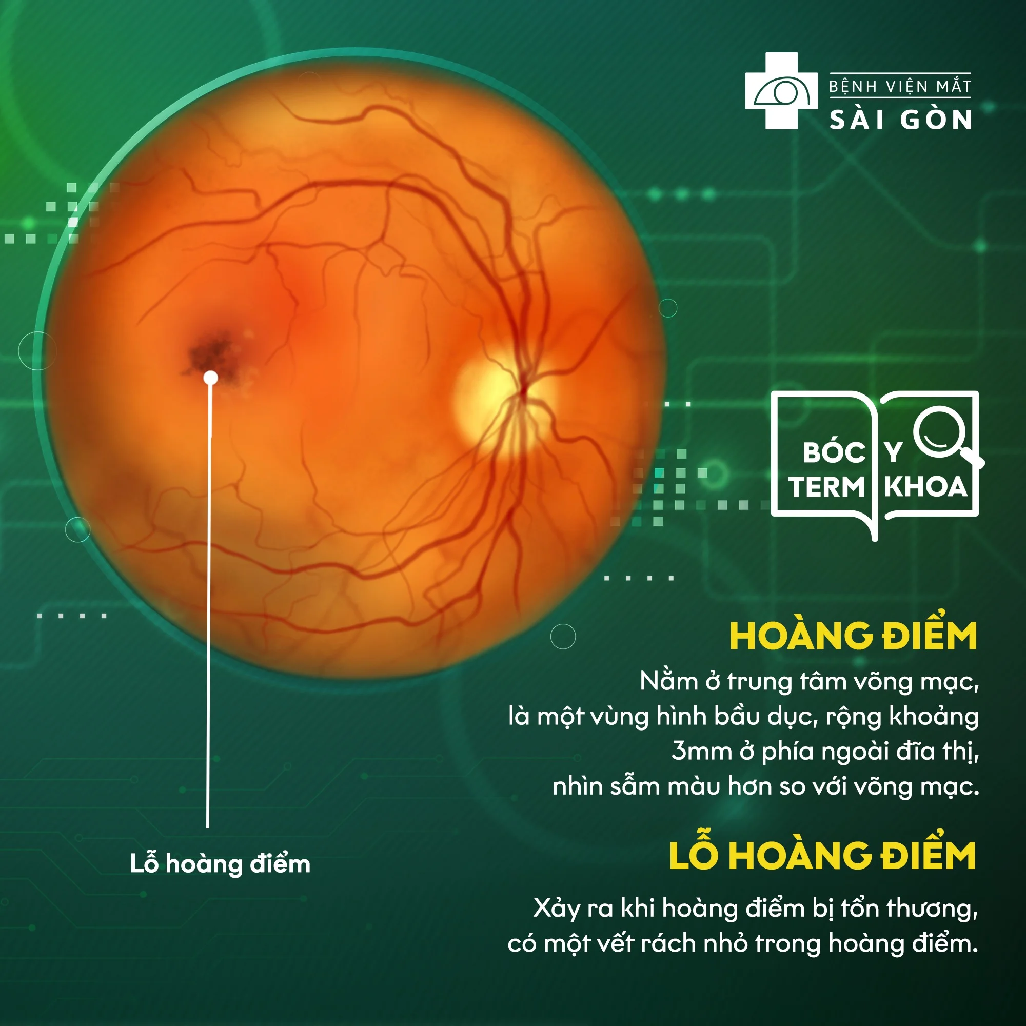 Hoàng điểm là cơ quan nào ?