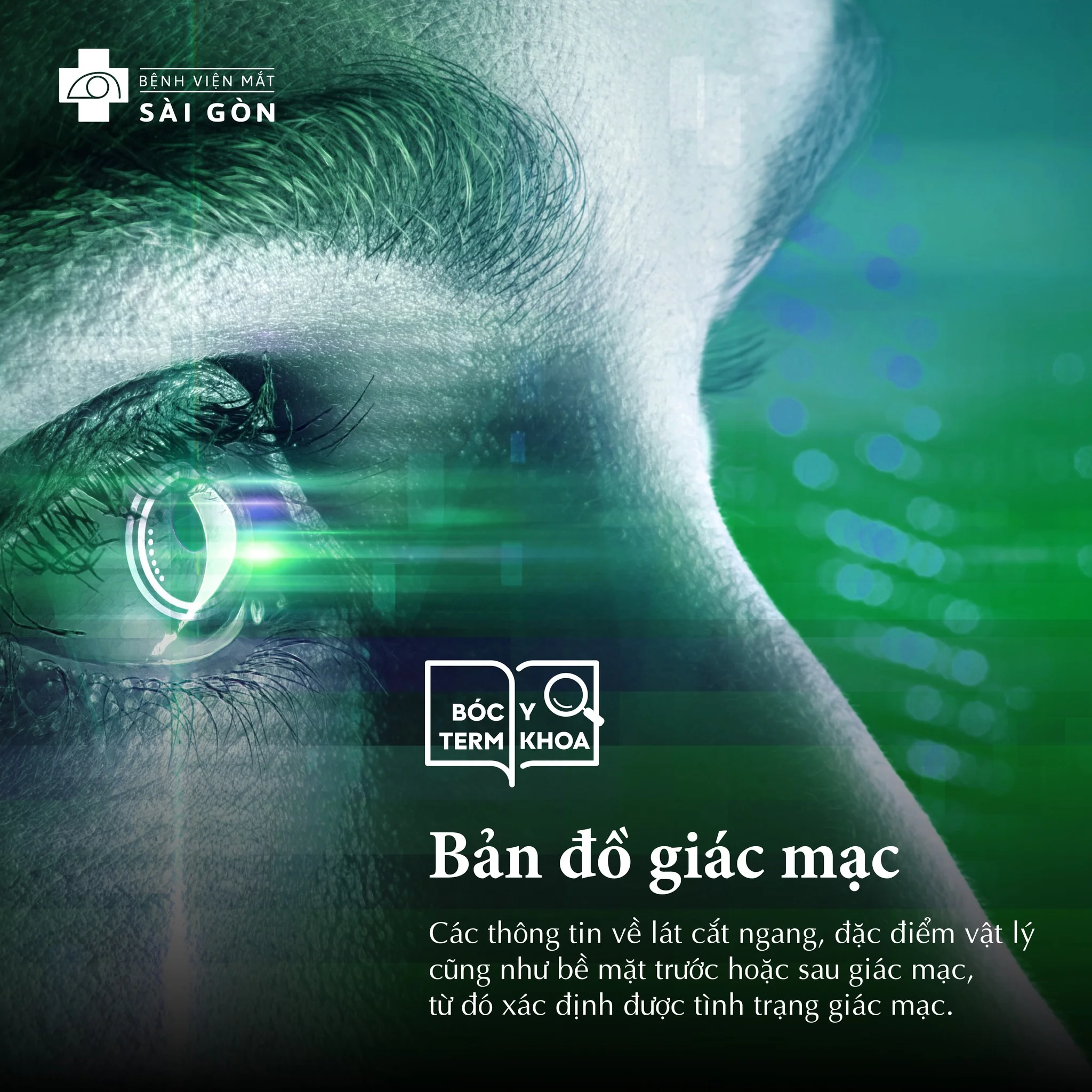 Bản đồ giác mạc