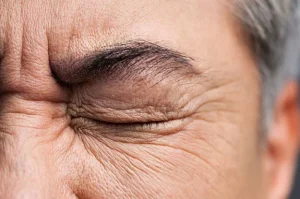 Chăm sóc mắt cho người già