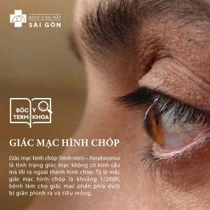 GIác mạc hình chóp