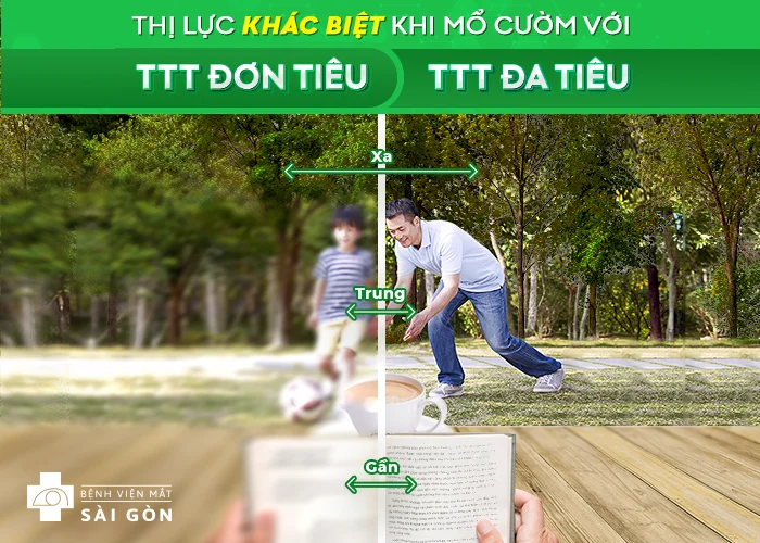 Sự khác biệt về tầm nhìn và thị lực giữa thủy tinh thể đơn tiêu và đa tiêu