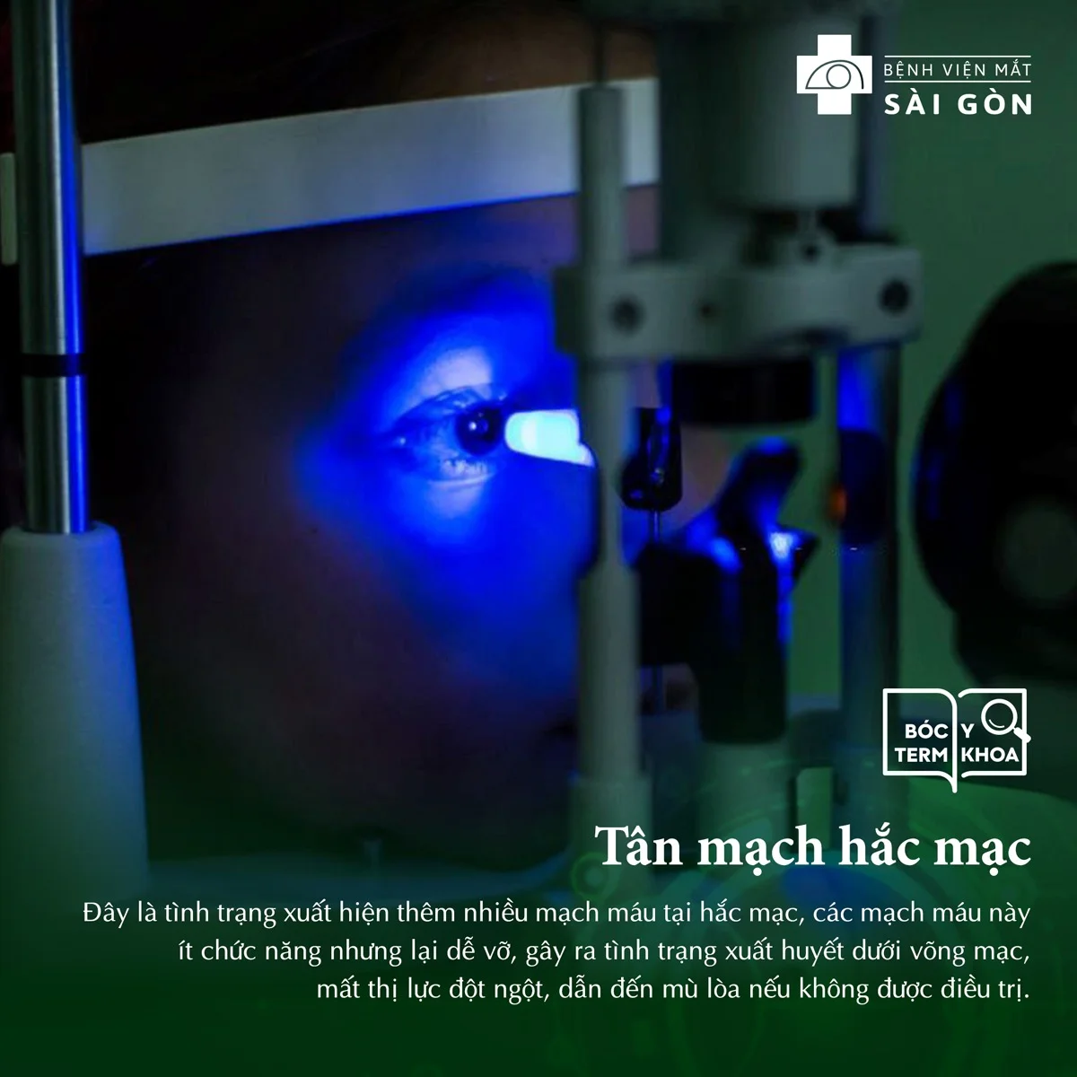 Tân mạch hắc mạc
