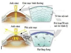 Tế bào nội mô