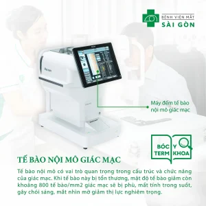 Tế bào nội mô giác mạc