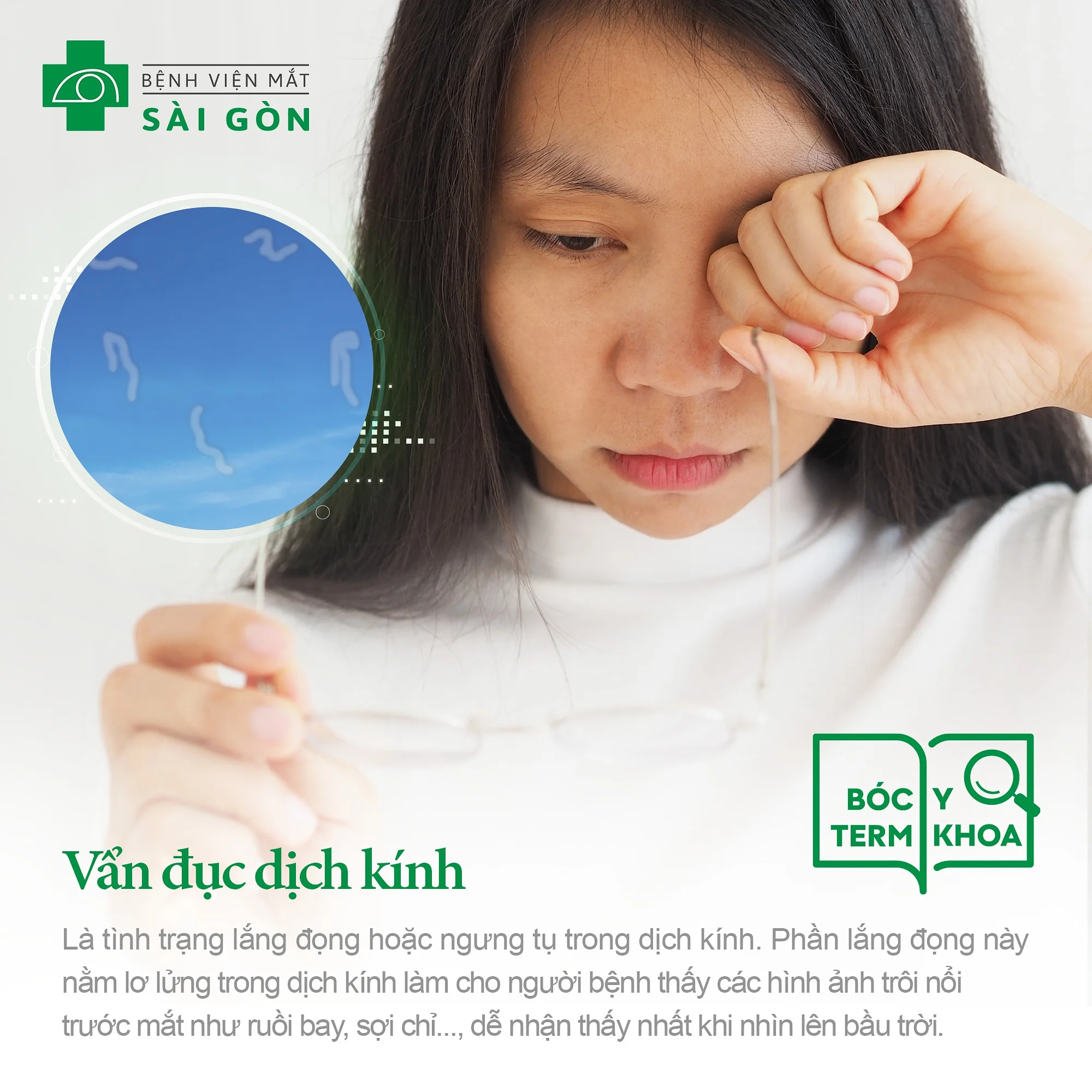 Vẫn đục dịch kính